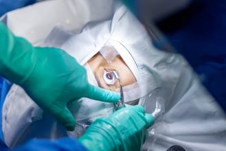 ¿Cómo limpiar el ojo después de una cirugía? Guía postoperatoria 2025